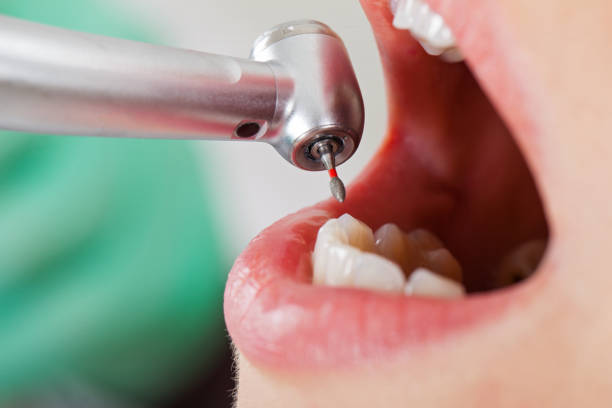 Best Emergency Dental Care for Abscessed Tooth in Wickliffe, OH